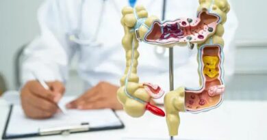 Alimentos crucíferos reduzem risco de câncer de intestino em 20%, aponta estudo