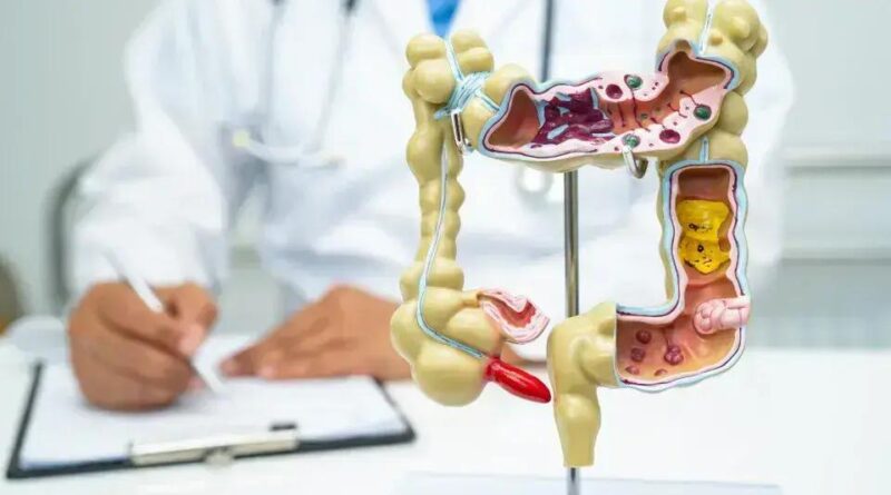Alimentos crucíferos reduzem risco de câncer de intestino em 20%, aponta estudo