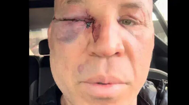 Wanderlei Silva relata agressão após luta com Popó no Spaten Fight Night