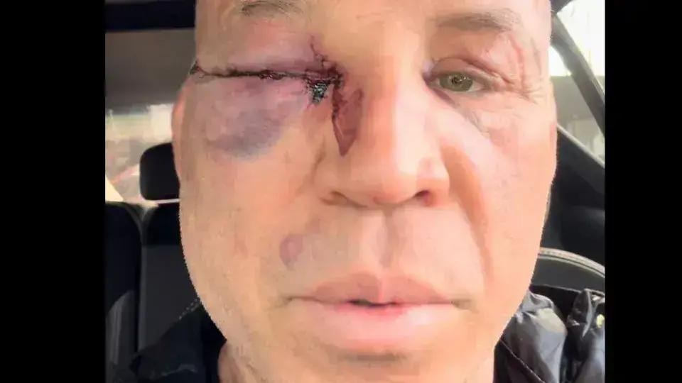 Wanderlei Silva relata agressão após luta com Popó no Spaten Fight Night