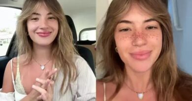 Influencer viraliza com tatuagem de sardas no rosto e responde a críticas