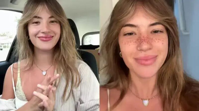 Influencer viraliza com tatuagem de sardas no rosto e responde a críticas