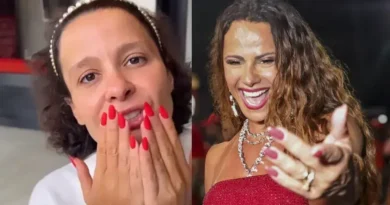 Celebridades que sofrem com alopecia e o desafio da perda de cabelo