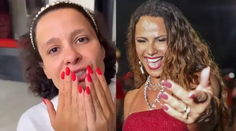 Celebridades que sofrem com alopecia e o desafio da perda de cabelo
