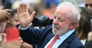 Lula passa por cirurgia para remover carcinoma basocelular e tendinite