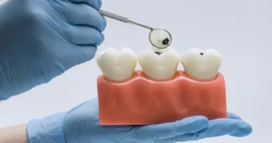 Alimentos que prejudicam o esmalte dentário e como evitar danos