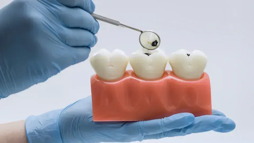Alimentos que prejudicam o esmalte dentário e como evitar danos