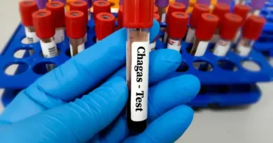 Risco Aumentado de Morte para Pacientes com Doença de Chagas em Cirurgias