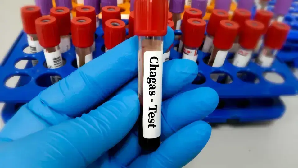 Risco Aumentado de Morte para Pacientes com Doença de Chagas em Cirurgias