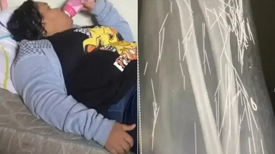 Mulher finge ser criança para ser adotada e revela passado perturbador