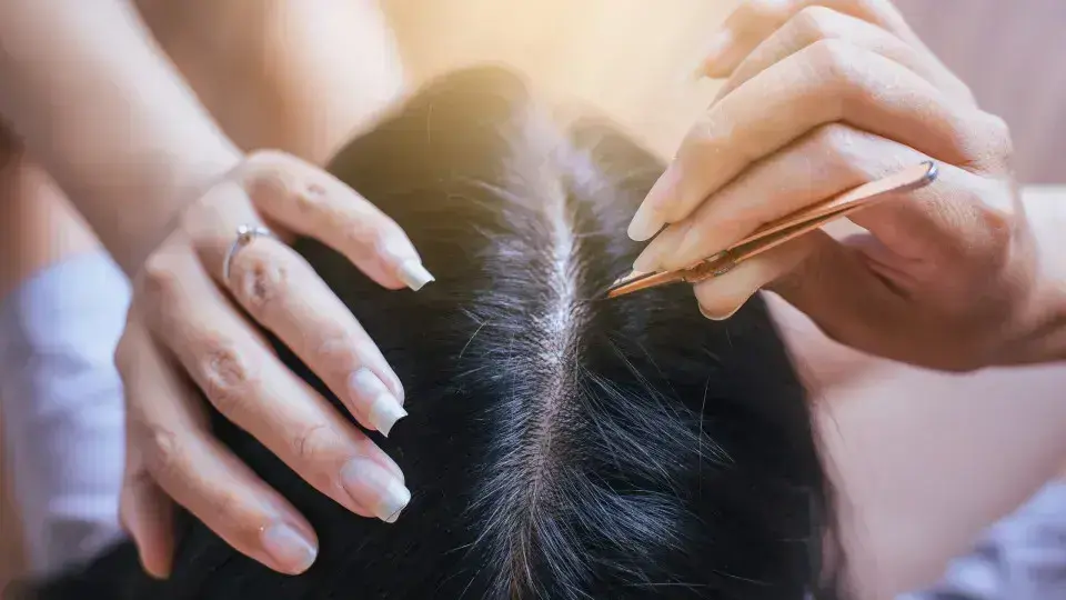 Arrancar cabelo branco: o que a dermatologista conta sobre isso?